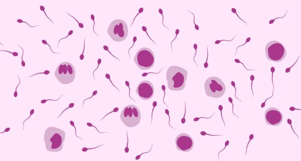 Nekrozoospermiya