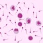 Nekrozoospermiya 85x85