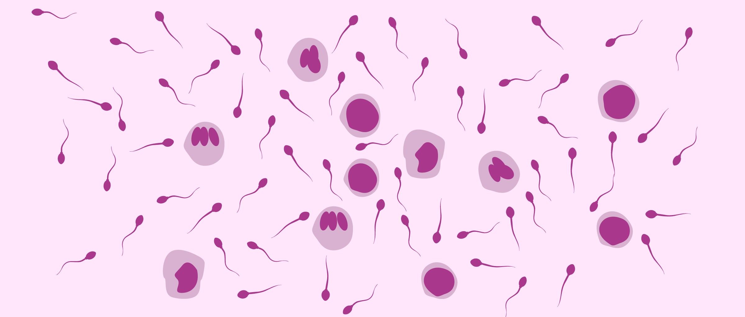 Nekrozoospermiya