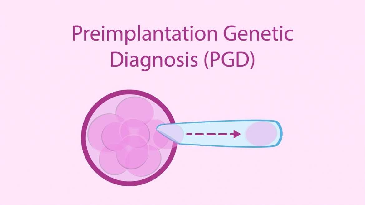 PGD Nima