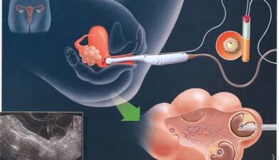 Sun'iy Urug'lantirish